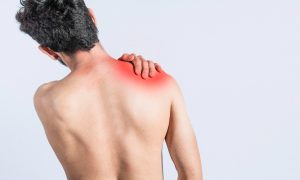 Shoulder Surgery