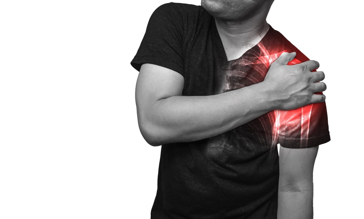 Chronic Shoulder Instability