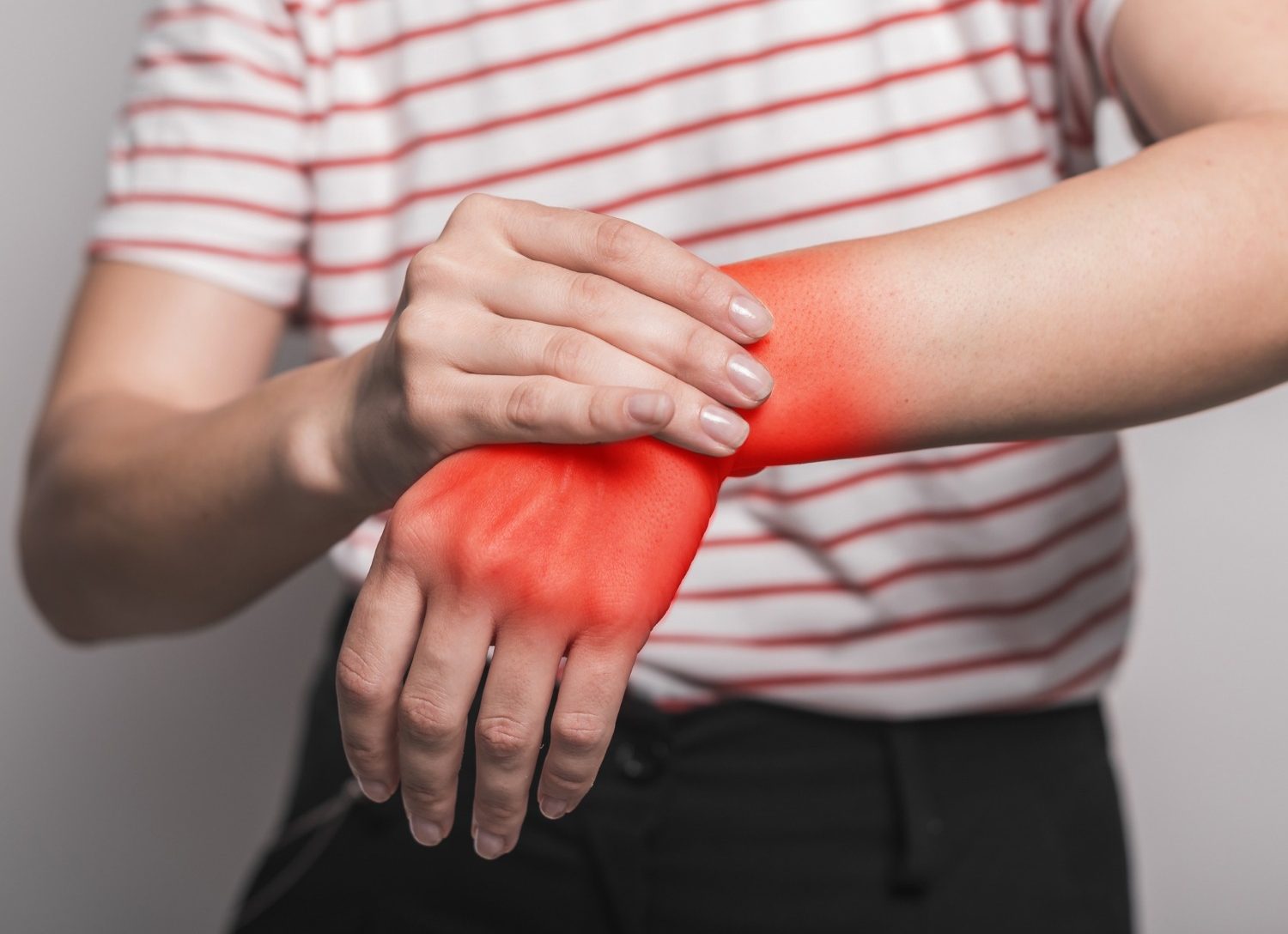 Guyon's Canal Syndrome (Ulnar Nerve at Wrist)