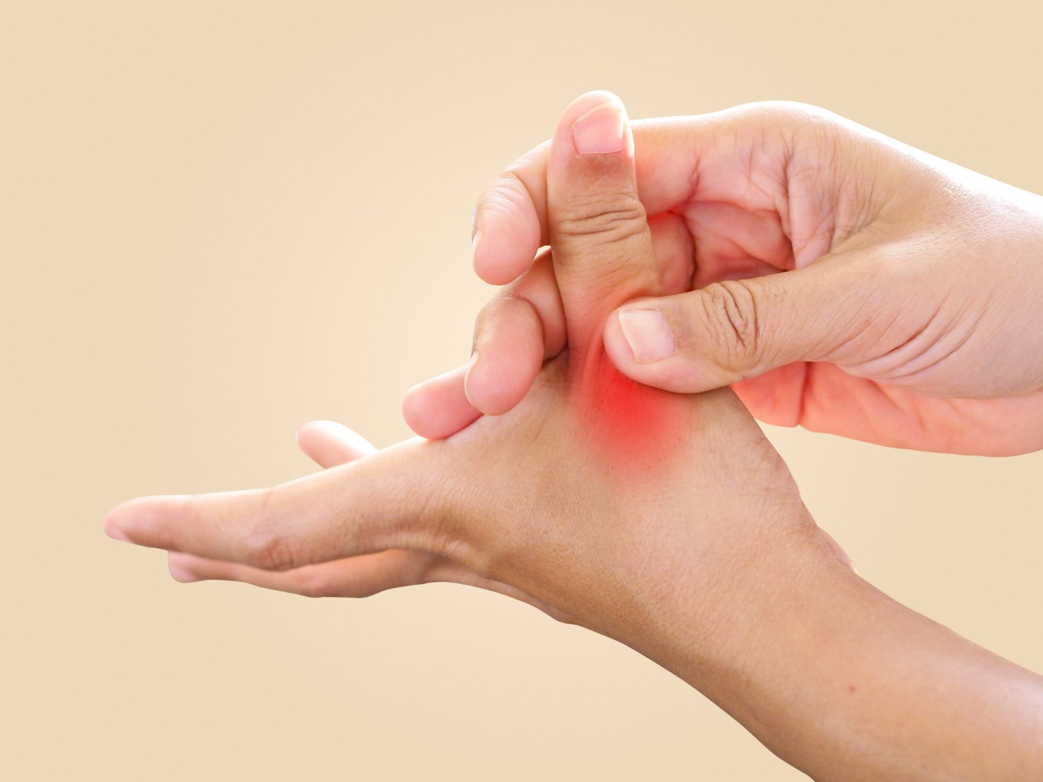 Thumb Basal Joint Arthritis (CMC Arthritis)