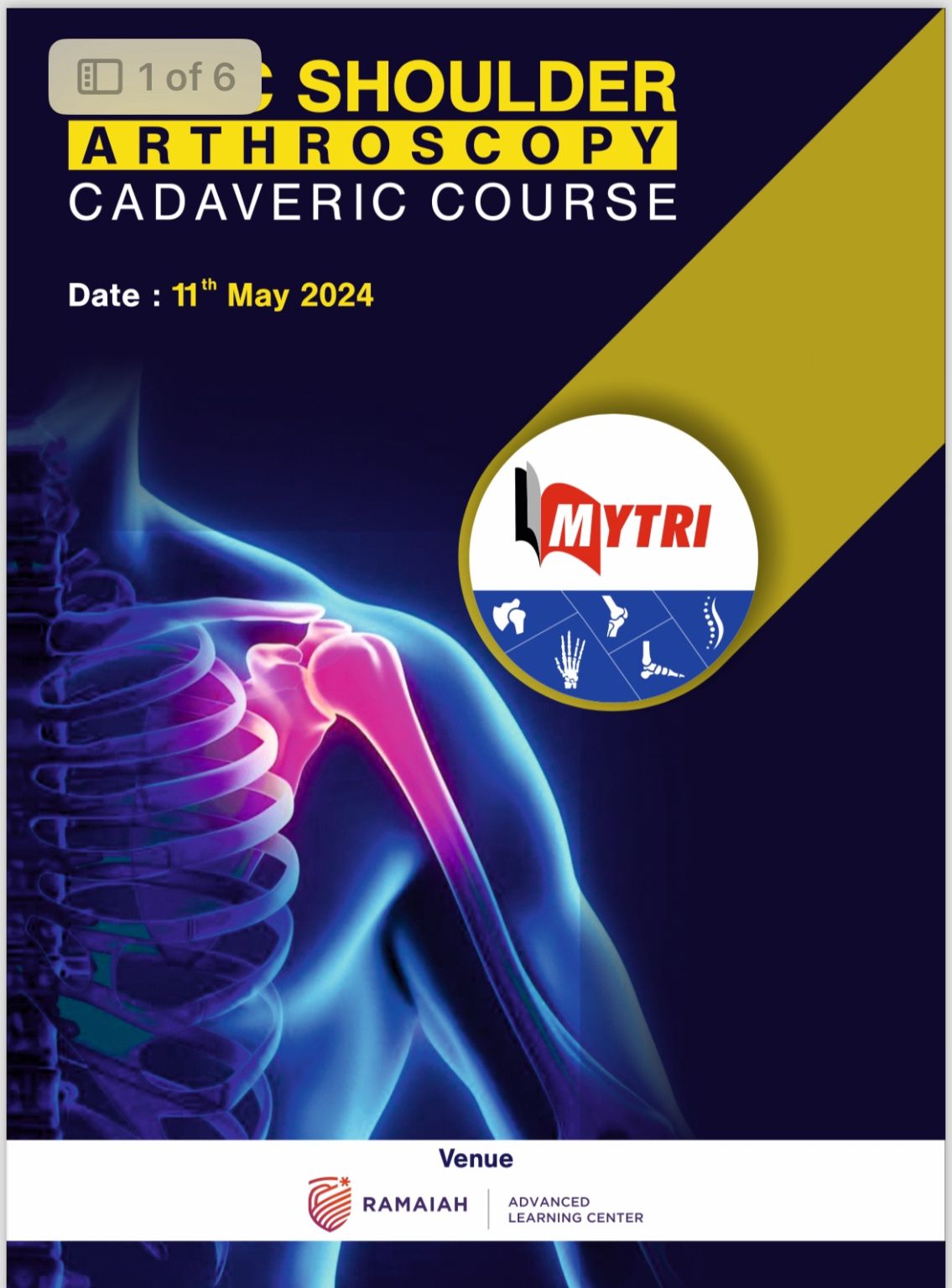 Shoulder Cadaveric Arthroscopy Course at MS Ramaiah Learning Centre