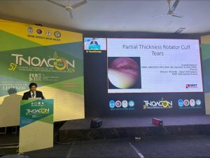 Gold Medal at TNOA 2024 for Tamil Oxford Shoulder Score Study