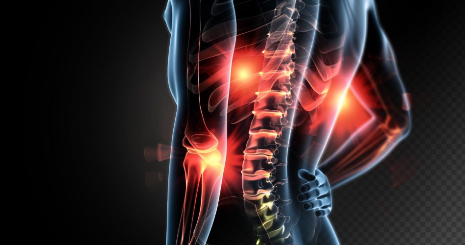 Hip Replacement