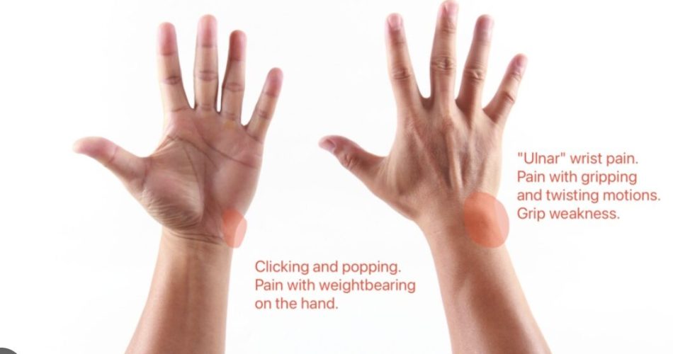 TFCC Injuries & Ulnar-Sided Wrist Pain