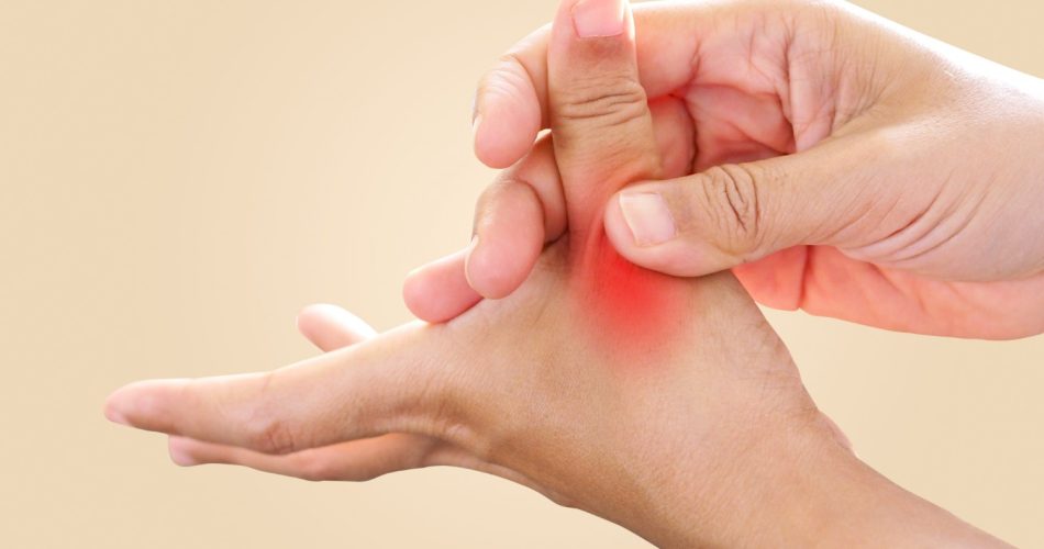 Thumb Basal Joint Arthritis (CMC Arthritis)