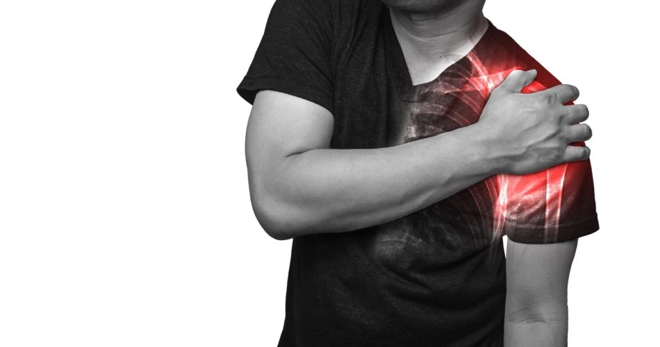 Chronic Shoulder Instability